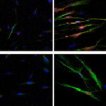 Human Dental pulp stem cells (hDPSCs): isolation, enrichment and comparative differentiation of two sub-populations Human Dental pulp stem cells (hDPSCs): isolation, enrichment and comparative differentiation of two sub-populations