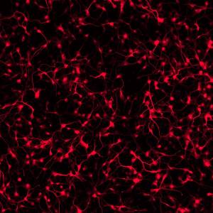 stem cells to treat Parkinson’s Disease