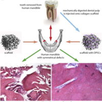 Dental pulp stem cells: State of the art and suggestions for a true translation of research into therapy Dental pulp stem cells: State of the art and suggestions for a true translation of research into therapy