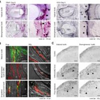 Functional Tooth Regeneration Using a Bioengineered Tooth Unit as a Mature Organ Replacement Regenerative Therapy Functional Tooth Regeneration Using a Bioengineered Tooth Unit as a Mature Organ Replacement Regenerative Therapy