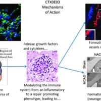 Human Neural Stem Cell Therapy for Chronic Ischemic Stroke: Charting Progress from Laboratory to Patients Human Neural Stem Cell Therapy for Chronic Ischemic Stroke: Charting Progress from Laboratory to Patients