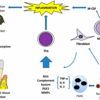 Mesenchymal Stem Cells of Dental Origin for Inducing Tissue Regeneration in Periodontitis - A Mini-Review Mesenchymal Stem Cells of Dental Origin for Inducing Tissue Regeneration in Periodontitis - A Mini-Review