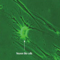 Human dental pulp stem cells: Applications in future regenerative medicine Human dental pulp stem cells: Applications in future regenerative medicine