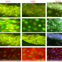 Intraventricular Injection of Human Dental Pulp Stem Cells Improves Hypoxic-Ischemic Brain Damage in Neonatal Rats Dental Stem Cell Research Publications - Intraventricular Injection of Human Dental Pulp Stem Cells Improves Hypoxic-Ischemic Brain Damage in Neonatal Rats