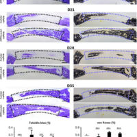 Accelerated craniofacial bone regeneration through dense collagen gel scaffolds seeded with dental pulp stem cells Dental Stem Cell Research Papers: Accelerated craniofacial bone regeneration through dense collagen gel scaffolds seeded with dental pulp stem cells